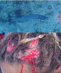 Unusually Korey failed to make a killing headshot on this 1.5-m barracuda 30 m down the Fathom. The powerful but mortally wounded fish pulled the barbless spear from its neck, slowly circled and darted at Korey, inflicting these wounds.